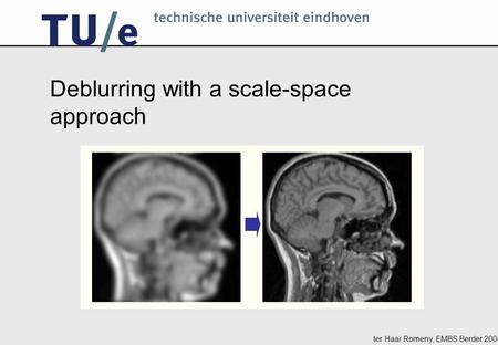 Ter Haar Romeny, EMBS Berder 2004 Deblurring with a scale-space approach.