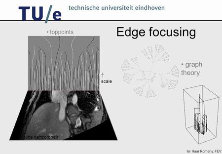 Ter Haar Romeny, FEV MR slice hartcoronair  scale toppoints graph theory Edge focusing.