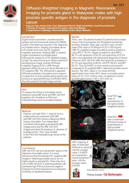 Diffusion-Weighted Imaging in Magnetic Resonance Imaging for prostate gland in Malaysian males with high prostate specific antigen in the diagnosis of.