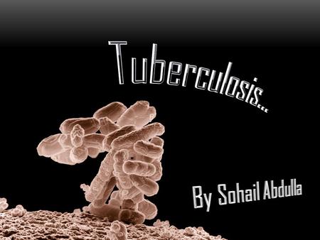 Tuberculosis… By Sohail Abdulla.