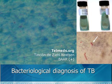 Bacteriological diagnosis of TB