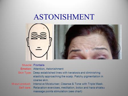 ASTONISHMENT Muscle: Frontalis Emotion: Attention, Astonishment Skin Type: Deep established lines with keratosis and diminishing elasticity approaching.