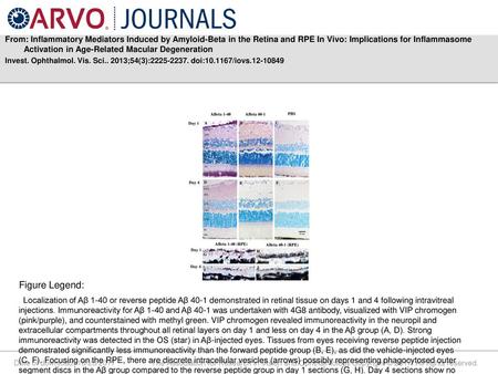 From: Inflammatory Mediators Induced by Amyloid-Beta in the Retina and RPE In Vivo: Implications for Inflammasome Activation in Age-Related Macular Degeneration.