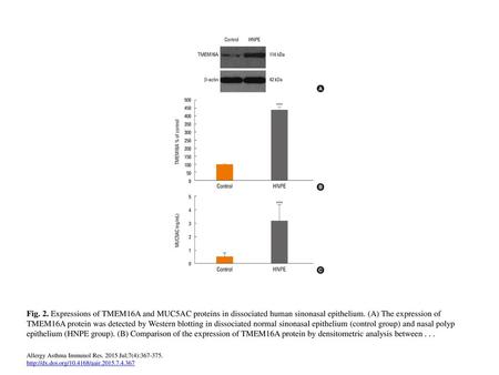 Fig. 2. Expressions of TMEM16A and MUC5AC proteins in dissociated human sinonasal epithelium. (A) The expression of TMEM16A protein was detected by Western.