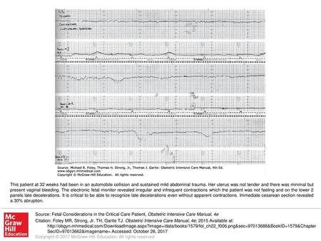 This patient at 32 weeks had been in an automobile collision and sustained mild abdominal trauma. Her uterus was not tender and there was minimal but present.