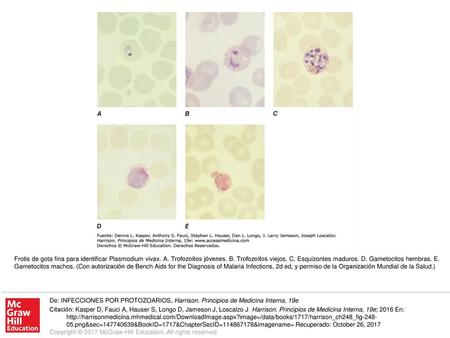 Frotis de gota fina para identificar Plasmodium vivax. A