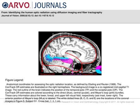 Journal of Vision. 2008;8(10):12. doi: / Figure Legend: