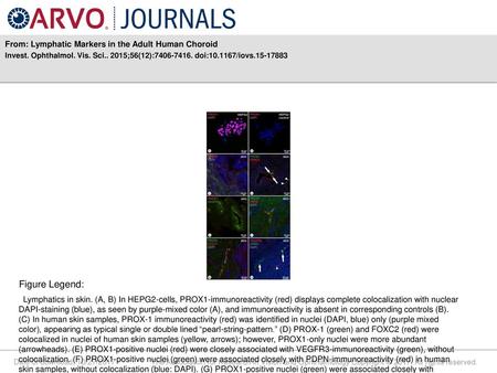 Figure Legend: From: Lymphatic Markers in the Adult Human Choroid