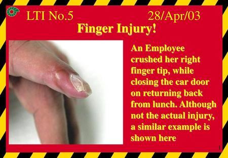 LTI No.5 28/Apr/03 Finger Injury!