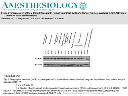 From: Overexpression of the μ-Opioid Receptor in Human Non-Small Cell Lung Cancer Promotes Akt and mTOR Activation, Tumor Growth, and Metastasis Anesthes.