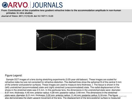 From: Contribution of the crystalline lens gradient refractive index to the accommodation amplitude in non-human primates: In vitro studies Journal of.