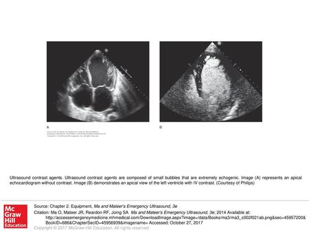 Ultrasound contrast agents