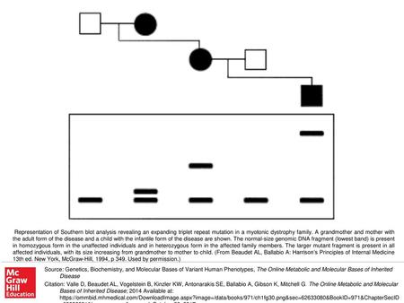 Representation of Southern blot analysis revealing an expanding triplet repeat mutation in a myotonic dystrophy family. A grandmother and mother with the.