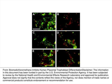 FIG. 1. Effect of BDCM on the organization of desmosomal proteins in trophoblast cultures. Cytotrophoblast cells were incubated with or without BDCM under.