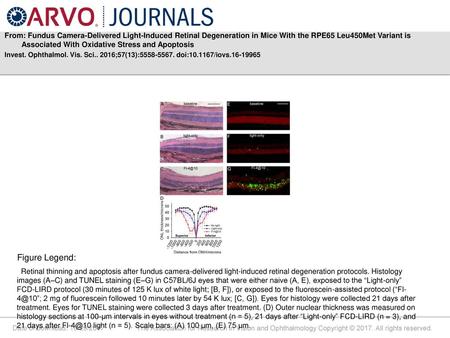 From: Fundus Camera-Delivered Light-Induced Retinal Degeneration in Mice With the RPE65 Leu450Met Variant is Associated With Oxidative Stress and Apoptosis.