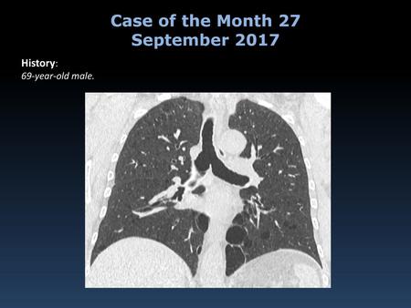 Case of the Month 27 September 2017