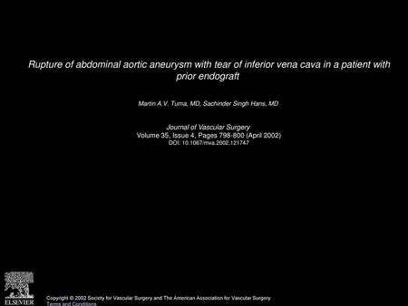 Rupture of abdominal aortic aneurysm with tear of inferior vena cava in a patient with prior endograft  Martin A.V. Tuma, MD, Sachinder Singh Hans, MD 