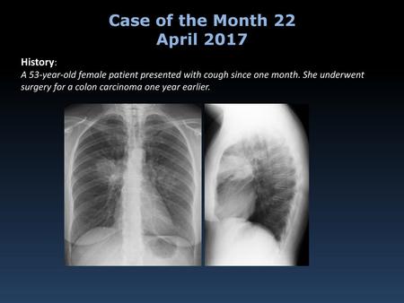 Case of the Month 22 April 2017 History: