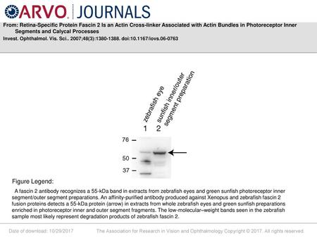 From: Retina-Specific Protein Fascin 2 Is an Actin Cross-linker Associated with Actin Bundles in Photoreceptor Inner Segments and Calycal Processes Invest.