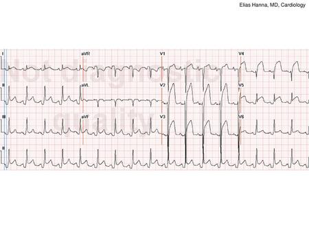 Elias Hanna, MD, Cardiology