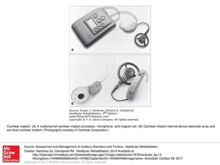 Cochlear implant. (A) A multichannel cochlear implant processor, microphone, and magnet coil. (B) Cochlear implant internal device electrode array and.