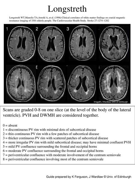 Longstreth Longstreth WT,Manolio TA,Arnold A, et al. (1996) Clinical correlates of white matter findings on cranial magnetic resonance imaging of 3301.