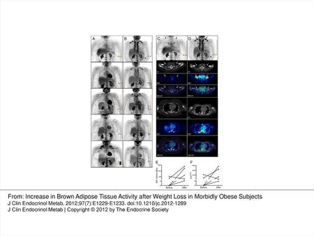 Fig. 1. BAT activity before and after WL