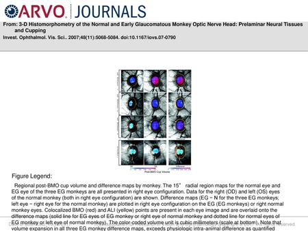 From: 3-D Histomorphometry of the Normal and Early Glaucomatous Monkey Optic Nerve Head: Prelaminar Neural Tissues and Cupping Invest. Ophthalmol. Vis.