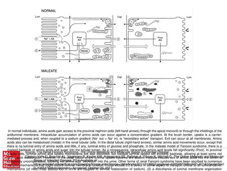 In normal individuals, amino acids gain access to the proximal nephron cells (left-hand arrows) through the apical microvilli or through the infoldings.