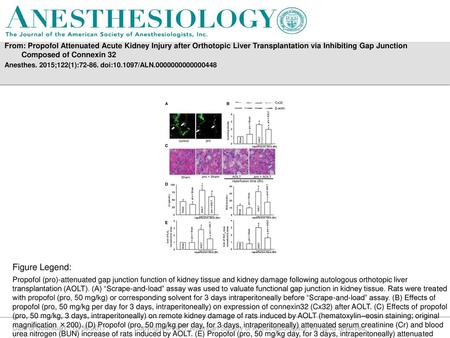 From: Propofol Attenuated Acute Kidney Injury after Orthotopic Liver Transplantation via Inhibiting Gap Junction Composed of Connexin 32 Anesthes. 2015;122(1):72-86.