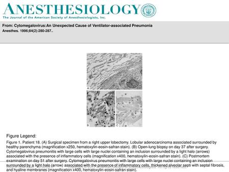 Anesthes. 1996;84(2): Figure Legend: