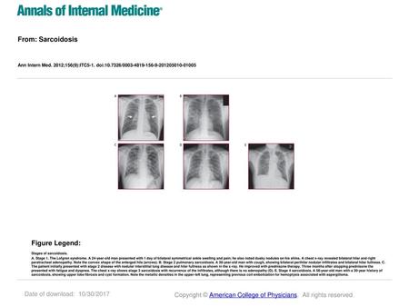 From: Sarcoidosis Figure Legend: Date of download: 10/30/2017