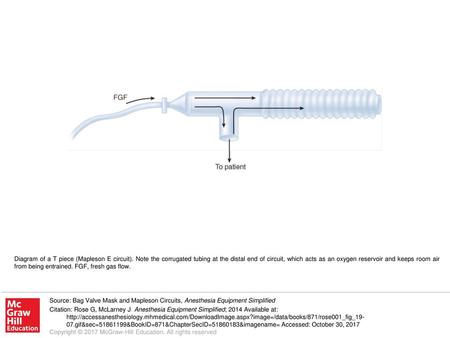 Diagram of a T piece (Mapleson E circuit)