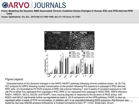 From: Modeling the Dynamic AMD-Associated Chronic Oxidative Stress Changes in Human ESC and iPSC-Derived RPE Cells Invest. Ophthalmol. Vis. Sci.. 2015;56(12):7480-7488.