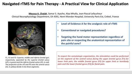 Navigated rTMS for Pain Therapy - A Practical View for Clinical Application Moussa A. Chalah, Samar S. Ayache, Alaa Mhalla, Jean-Pascal Lefaucheur Clinical.