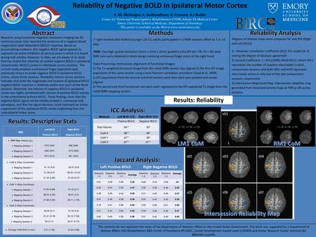 Reliability of Negative BOLD in Ipsilateral Motor Cortex