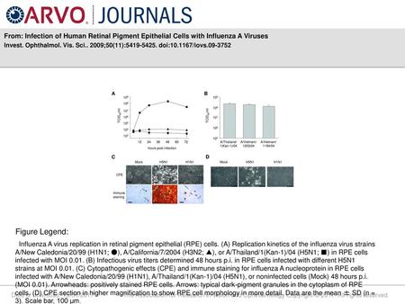 Invest. Ophthalmol. Vis. Sci ;50(11): doi: /iovs Figure Legend: