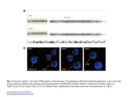 Fig. 1. Genomic analysis. (A) Array CGH analysis of chromosome 12 performed on DNA from blood lymphocytes. Log 2 ratio data are presented according to.