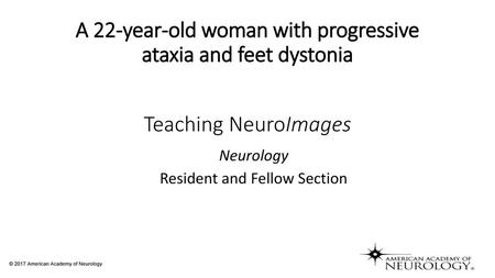 A 22-year-old woman with progressive ataxia and feet dystonia