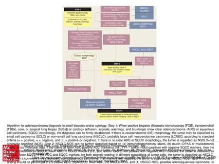 Algorithm for adenocarcinoma diagnosis in small biopsies and/or cytology. Step 1: When positive biopsies (fiberoptic bronchoscopy [FOB], transbronchial.