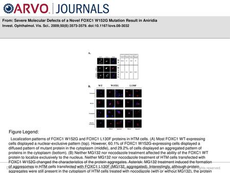 Invest. Ophthalmol. Vis. Sci ;50(8): doi: /iovs Figure Legend: