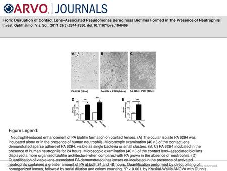 From: Disruption of Contact Lens–Associated Pseudomonas aeruginosa Biofilms Formed in the Presence of Neutrophils Invest. Ophthalmol. Vis. Sci.. 2011;52(5):2844-2850.