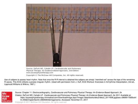 Use of calipers to assess heart rhythm