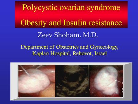 Polycystic ovarian syndrome Obesity and Insulin resistance