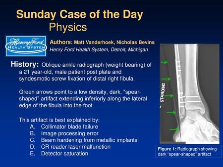 Sunday Case of the Day Physics