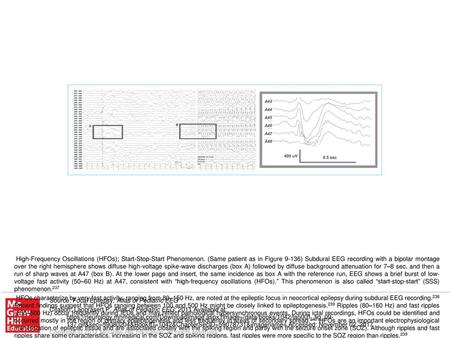 The SSS phenomenon is defined as a pair of sequential ictal potentials separated by complete or almost complete cessation of seizure activity; the SSS.