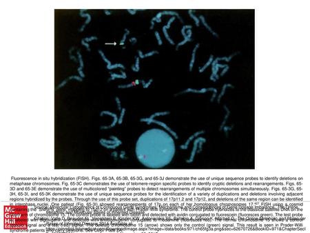 Fluorescence in situ hybridization (FISH). Figs