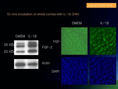 FGF-2 DAPI DMEM IL-1 FGF-2 Actin DMEM IL-1 25 KDa 20 KDa