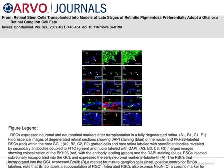 From: Retinal Stem Cells Transplanted into Models of Late Stages of Retinitis Pigmentosa Preferentially Adopt a Glial or a Retinal Ganglion Cell Fate Invest.