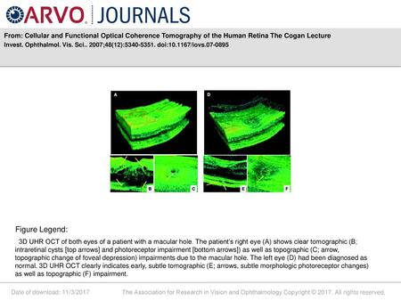 Invest. Ophthalmol. Vis. Sci ;48(12): doi: /iovs Figure Legend: